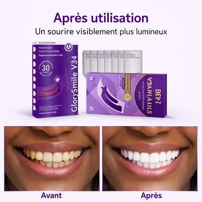 Sourire Éclatant™ – Bandes Blanchissantes Dents
