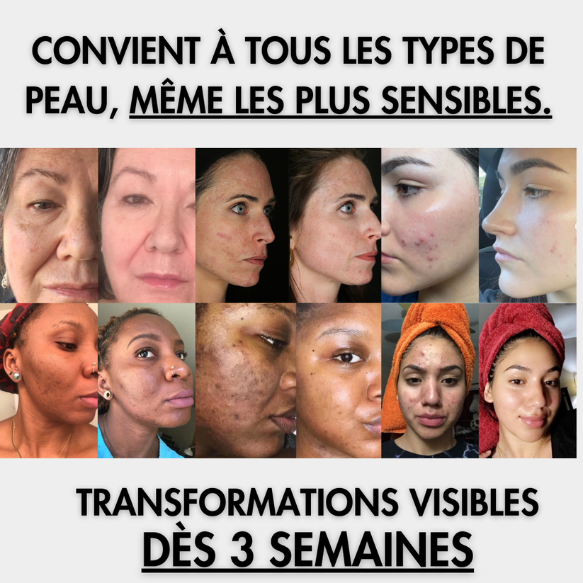 Cotons | Anti-taches Curcuma & Acid Kojique