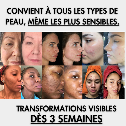 Cotons | Anti-taches Curcuma & Acid Kojique