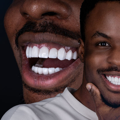 NKDSTORE™ Nettoyeur Dentaire Pro