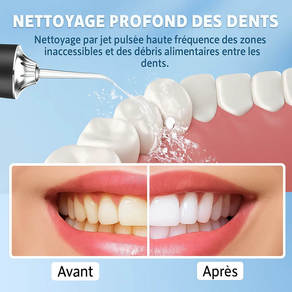 NKDSTORE™ Nettoyeur Dentaire Pro