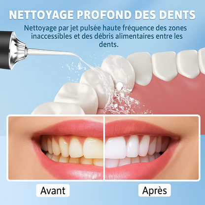 NKDSTORE™ Nettoyeur Dentaire Pro